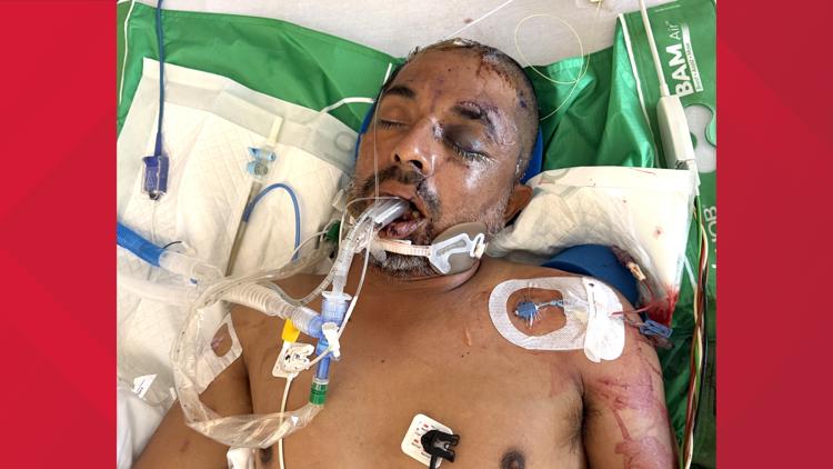 University Hospital asks for help identifying unconscious patient hit by truck Saturday evening — KENS 5 (San Antonio), Lafayette Health news